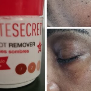 White Secret Dark Spot Remover